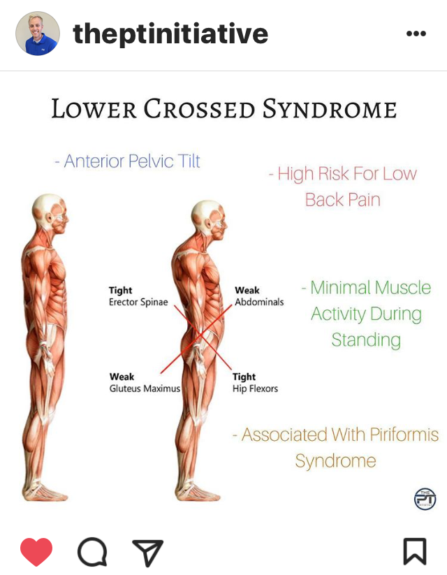 diagram-crossline-syndrome